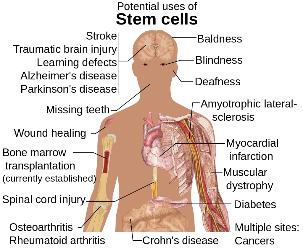 Diseases and conditions where stem cell treatment is promising or emerging.