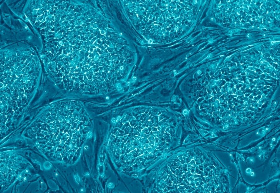 Embryonic Stem Cells stained blue under a microscope