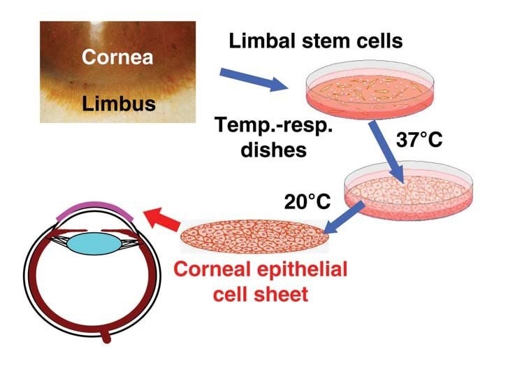 Stem Cells and corneal transplant