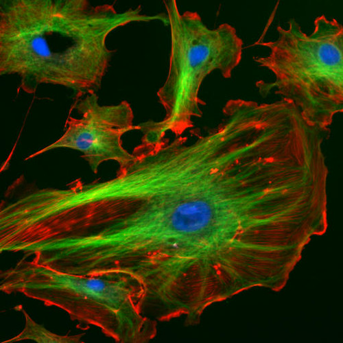  The cytoskeleton is a network of long protein chains (called filaments) which is responsible for maintaining the structure of the cell, as well as directing intracellular traffic. It is made of the actin filaments, microtubules, and intermediate filaments. The microtubules are marked green, and the actin filaments are red.