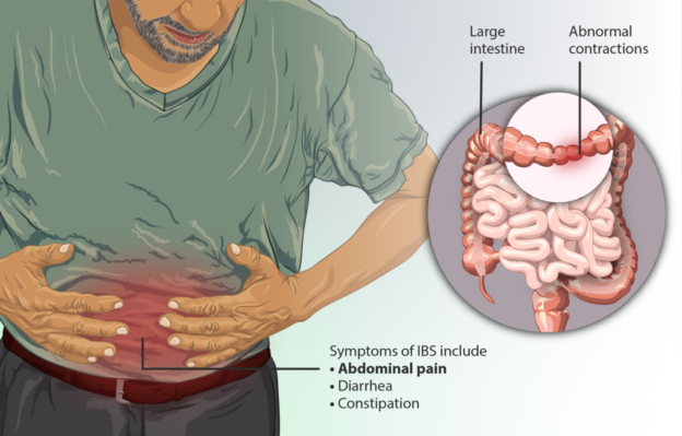 new-research-reveals-mechanism-that-causes-irritable-bowel-syndrome